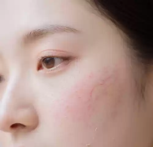 敏感肌图标